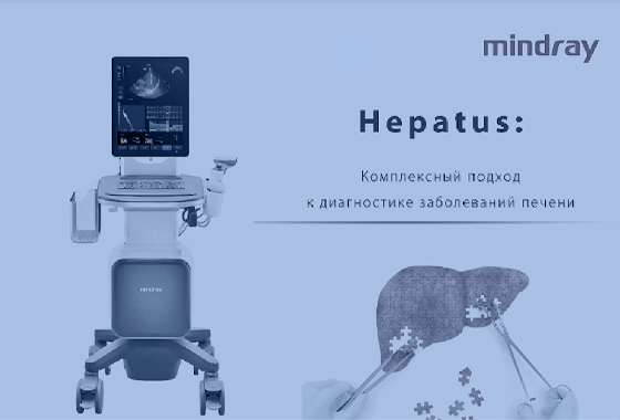 Сотрудники компании «МедАктив» прошли тренинг по ультразвуковому аппарату для исследования печени Hepatus